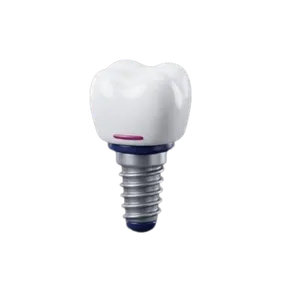 Implante Dental 3D
